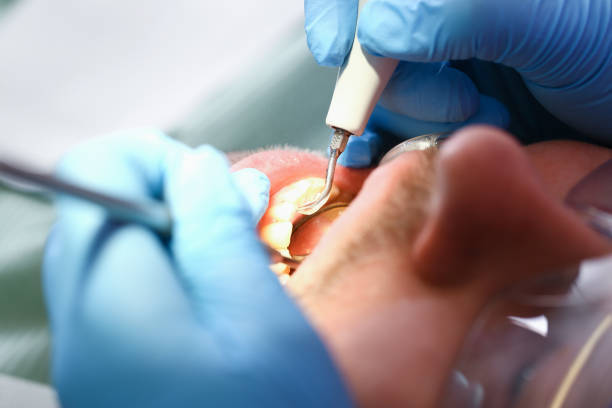 Best Weekend Emergency Dental Services in Tyro, NC