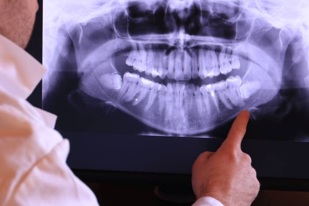 Best Emergency Cosmetic Dentistry (e.g., broken veneers) in Tyro, NC